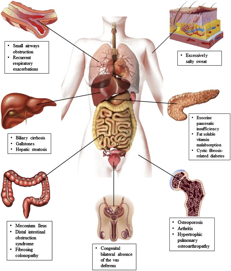 what body parts are affected by scid